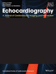 /tapasrevistas/echocardiography.jpg