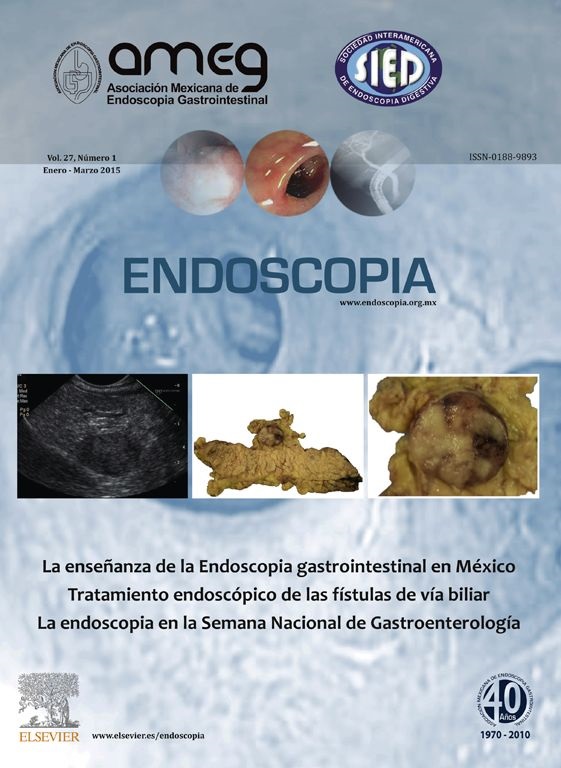 /tapasrevistas/endoscopia.jpg