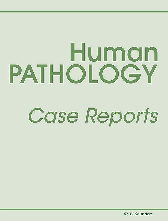 /tapasrevistas/humanpathologycasereports.jpg