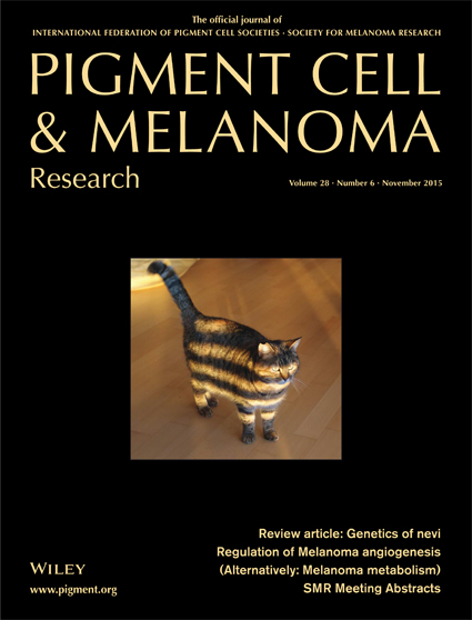 /tapasrevistas/pigment_cell_melanoma_res.jpg