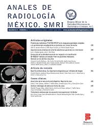 Anales de Radiología, México